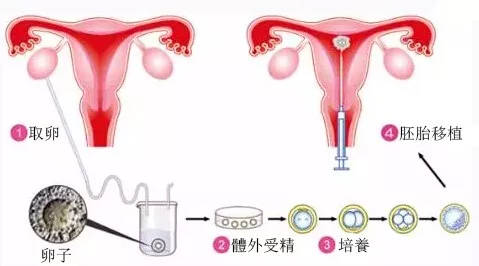 哪里做借卵做试管婴儿最好-哪里做借卵做试管婴儿好