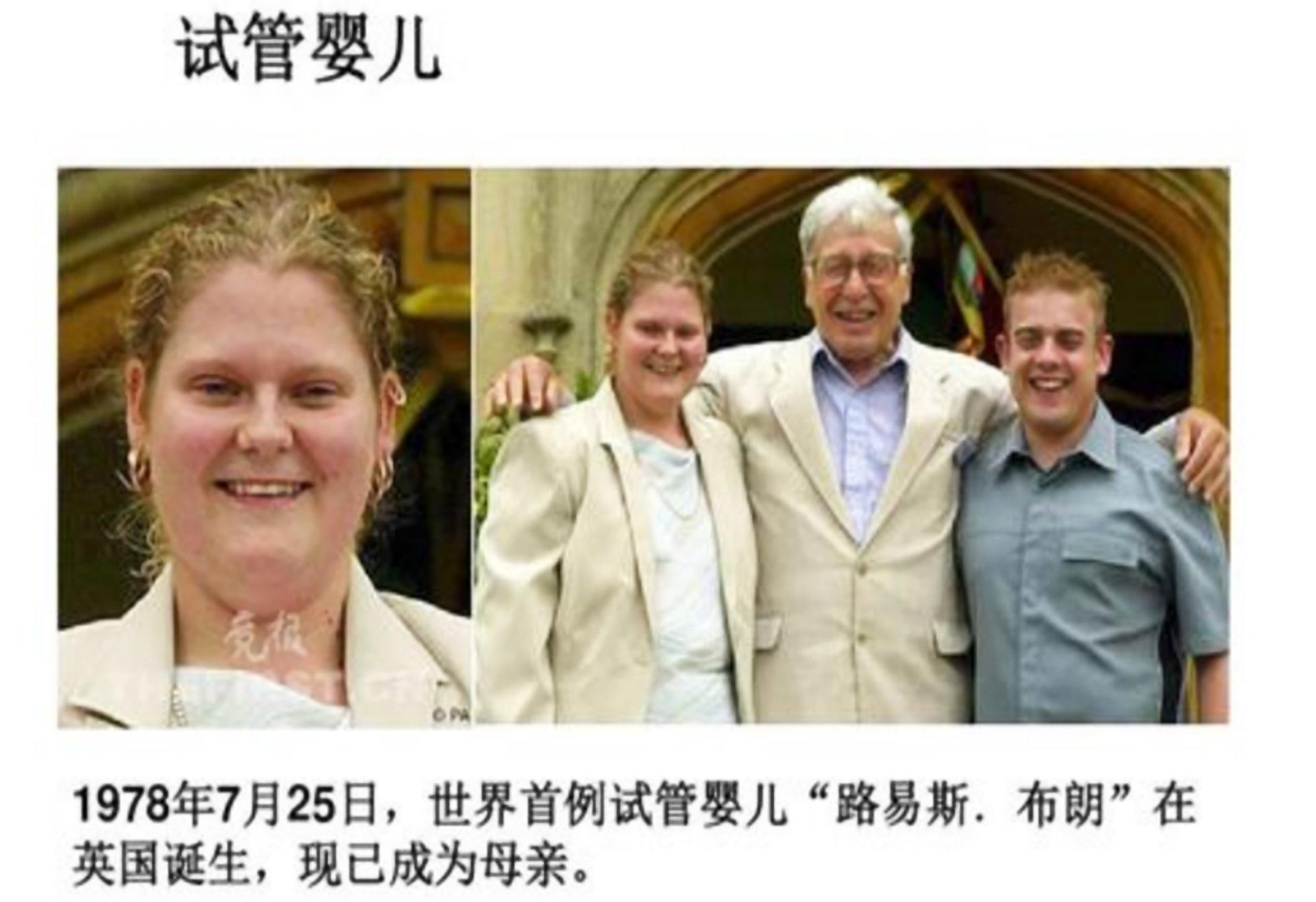CEF泰国供卵试管孕育医生。胚胎移植后要注意什么？