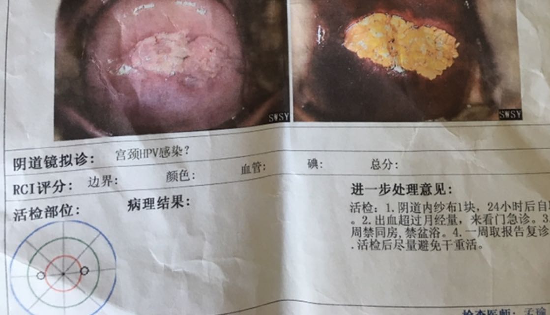 胎儿流产不一定非要清宫!不符合这3个条件，不需要刮宫