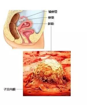 长春赠卵供卵代生试管费用大概要多少钱