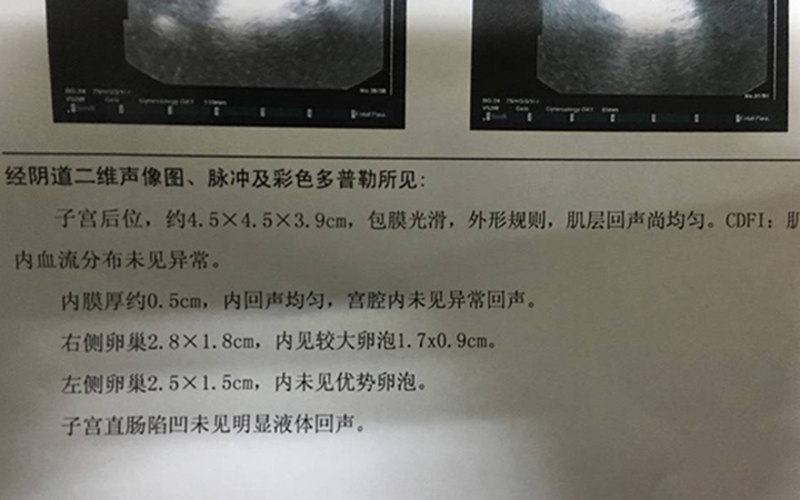 一个新鲜胚胎移植后会在子宫腔内形成两个胚胎吗？