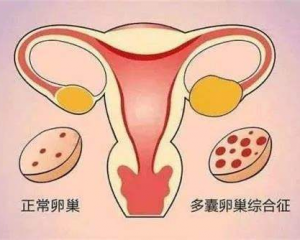 做完赠卵试管应该吃什么东西