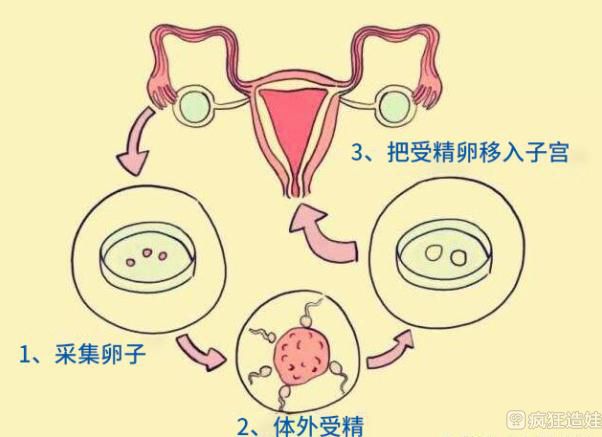 重庆哪家供卵试管婴儿做的好