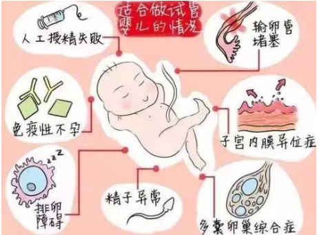 做借卵试管婴儿生孩子报销吗