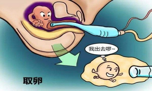重庆借卵做试管最好的医院