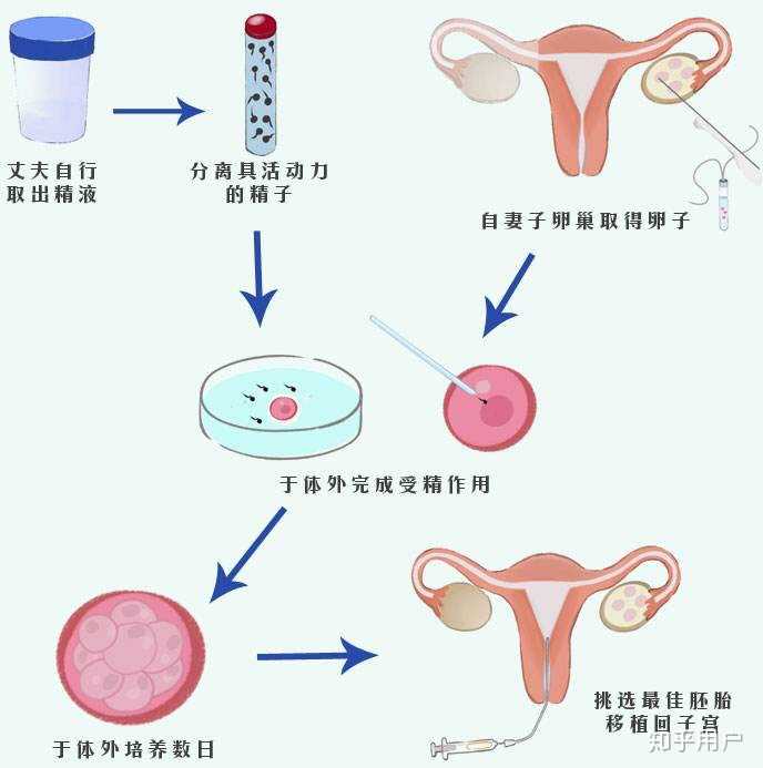 核酸做借卵试管生产厂家