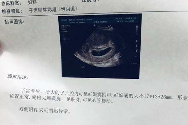 四十岁做试管的成功率