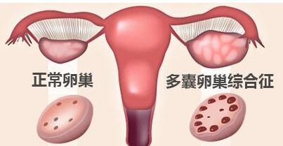 试管婴儿降调的目的