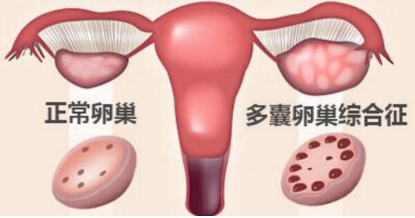 试管婴儿容易流产吗