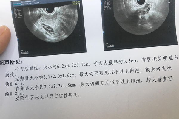 女人结扎了还能做试管婴儿怀孕吗