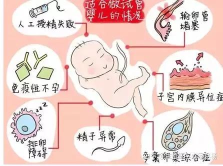 重庆省妇保试管成功率多少