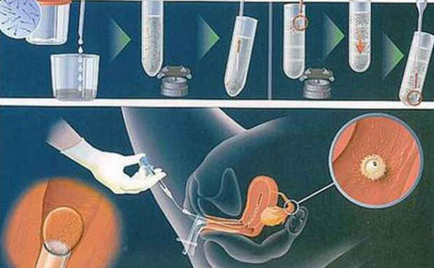 重庆市做试管成功率最高的医院排名,接受试管代怀包生男孩的条件