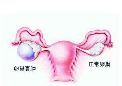 子宫动脉血流卵巢血供_子宫血流