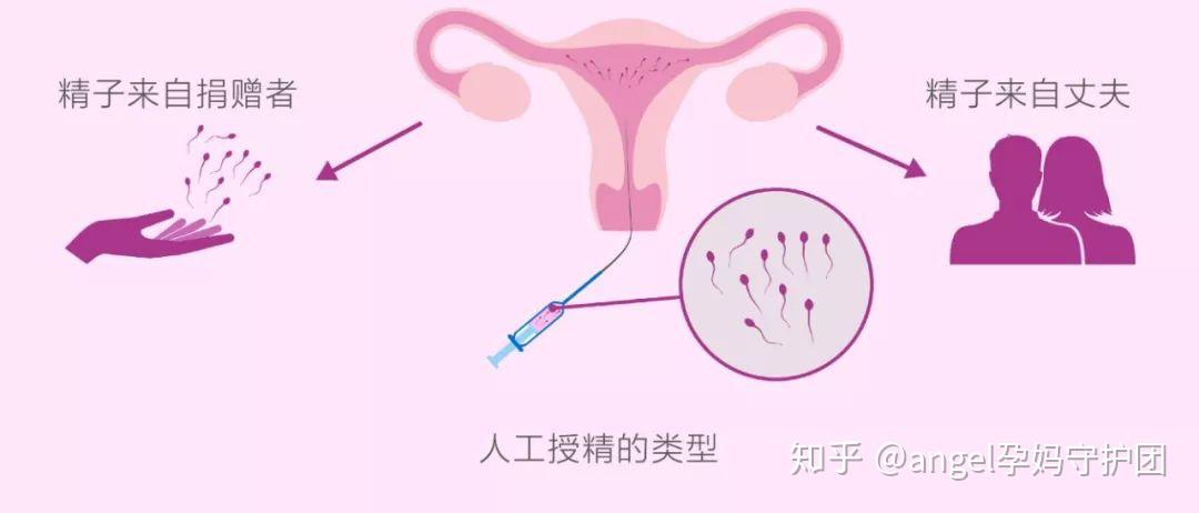 重庆市试管双胞胎长的一样吗？