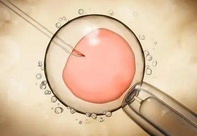 重庆第三代代怀选择性别怎么选费用是多少+借卵试管代怀的女人供卵机构如何选