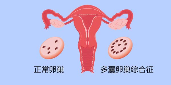 FSH值是什么（寻试管代怀产子婴儿有一次成功的吗？）